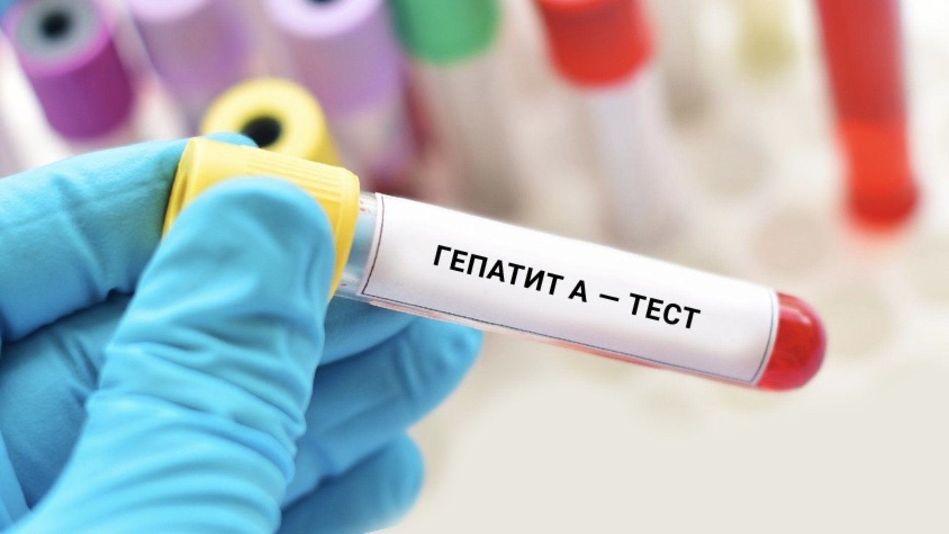 В Ізі на Хустщині запровадили щотижневе тестування на гепатит А для нещеплених школярів та дітей