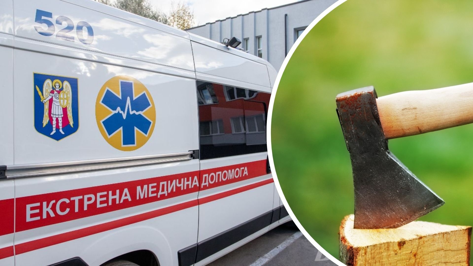 На Закарпатті підліток ледь не втратив око, граючись із сокирою (ФОТО)