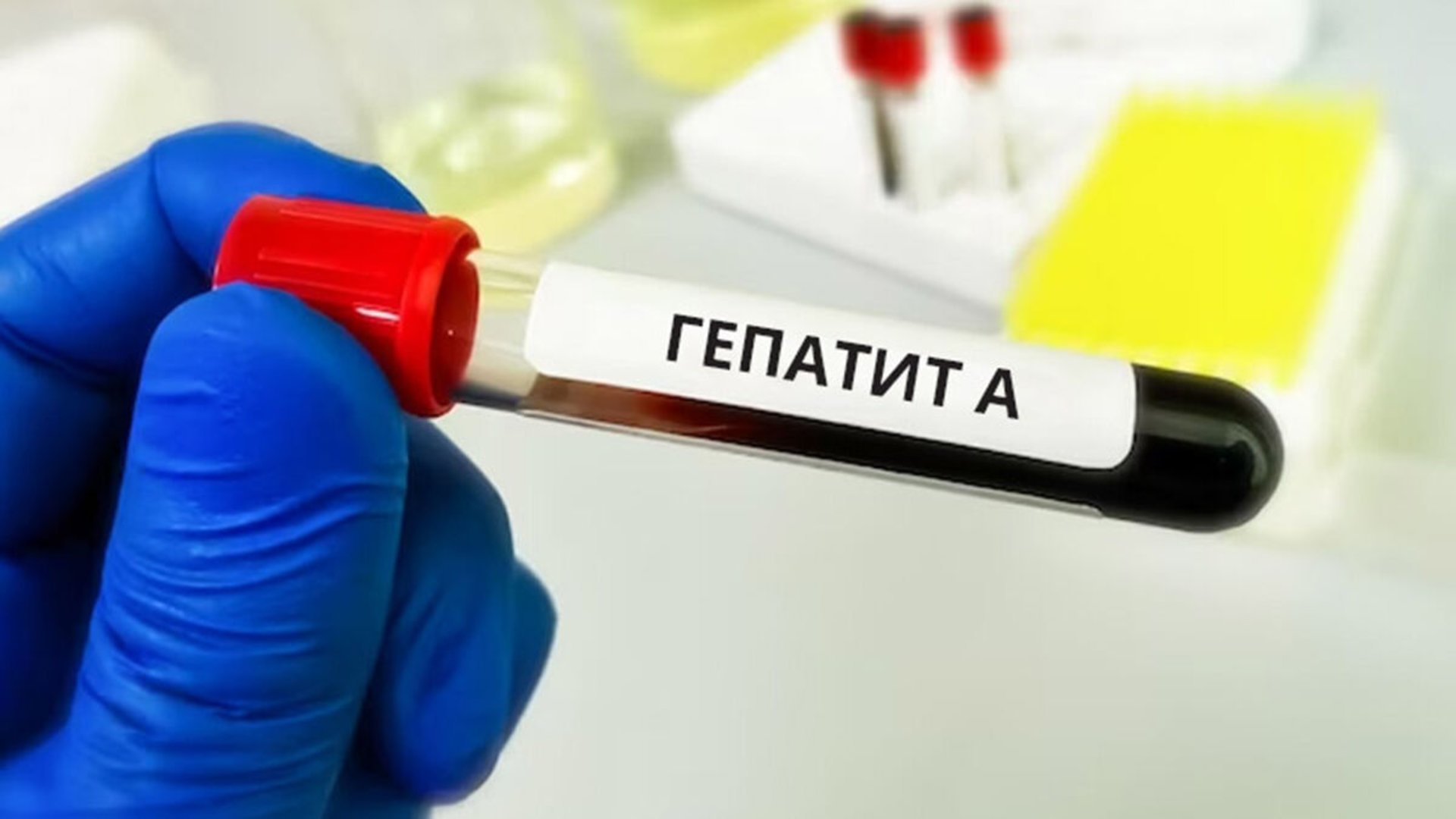 У Берегові збільшується кількість хворих на гепатит А